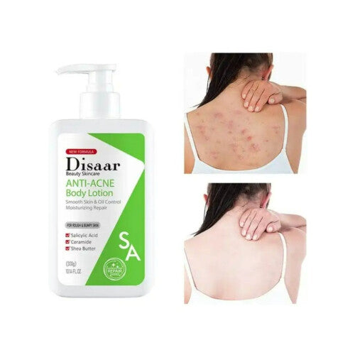Disaar Anti Acne Body Lotion 300g